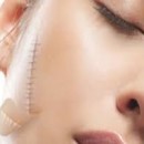 KEM DƯỠNG DA TRỊ SẸO